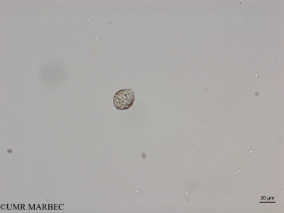 phyto/Brazilian_Nordeste/Northeastcoast_station25/ABRACOS1 October 2015/Dino 59 (Snap-01-copie)(copy)_thumb.jpg